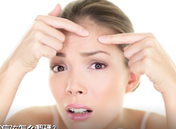 額頭長痘痘怎么調(diào)理 教你幾招祛痘方法