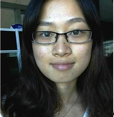 快速簡(jiǎn)單的祛痘方法 臉上長(zhǎng)痘痘怎么快速去除