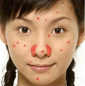 好臉面好面子 面部過敏怎么辦