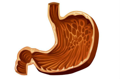 胃出血的癥狀 主要表現(xiàn)在三個(gè)方面