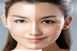 祛斑最好的方法，只送給愛美的你