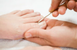 腳趾甲變厚怎么治療 辦法有3種