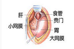 賁門疾病最常見之賁門炎