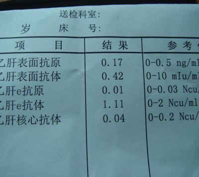 乙肝檢查 為你詳解乙肝的全套檢查
