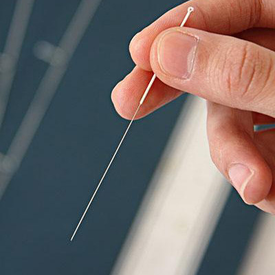 中醫(yī)美容調(diào)理  中醫(yī)針灸的功效