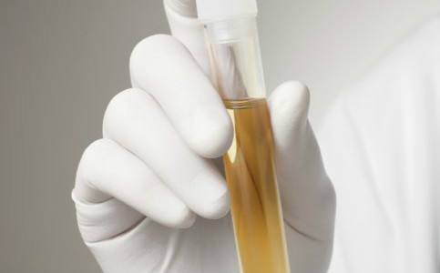 尿毒癥有什么癥狀 這6個方面要注意