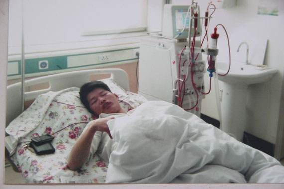 尿毒癥有什么癥狀 這6個方面要注意