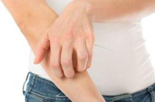 蕁麻疹的癥狀 主要有以下六種