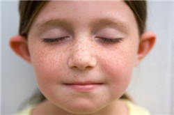 如何有效去除黃褐斑 黃褐斑的治療要內(nèi)外結(jié)合