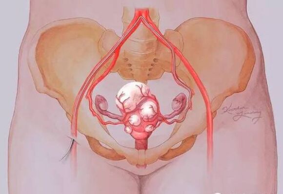 子宮保健 注意觀察月經(jīng)和白帶是否正常