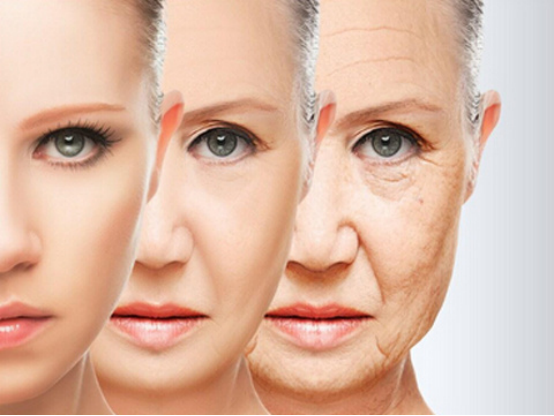 怎樣除去魚尾紋是愛美女性最關(guān)注的話題