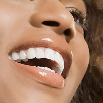 牙齒美白小竅門  七種方法