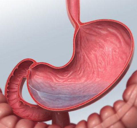 胃癌晚期癥狀與飲食禁忌介紹