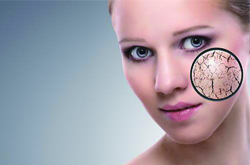 肌膚干燥怎么辦 7個(gè)補(bǔ)水招拯救沙漠肌