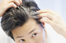 導(dǎo)致年輕人長白頭發(fā)的三大原因介紹