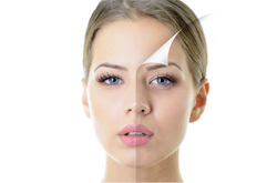 “吃走”黑斑 吃什么可以祛斑養(yǎng)顏