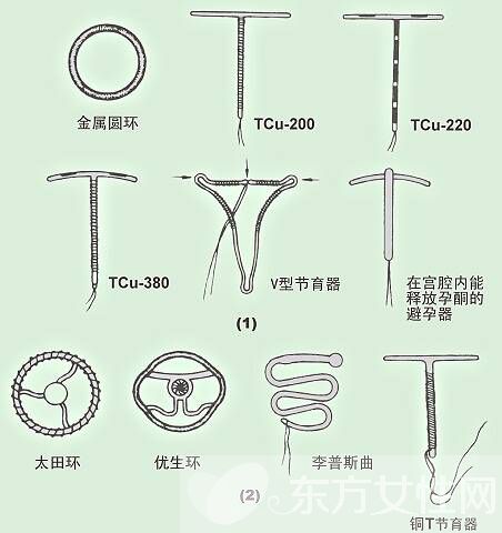 節(jié)育環(huán)哪種好 帶你認(rèn)識(shí)安環(huán)后的5大副作用