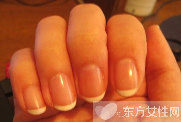 灰指甲會(huì)傳染嗎 灰指甲的護(hù)理方法