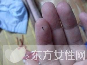 如何消滅跳蚤 消滅跳蚤的最佳辦法