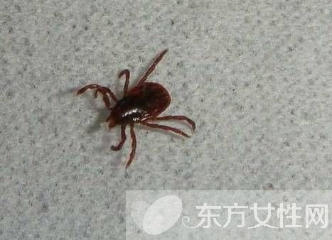 虱子咬的癥狀有哪些 怎樣去除虱子