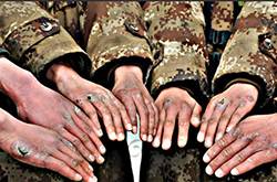 怎么治凍瘡 幾招教你怎樣預(yù)防凍瘡