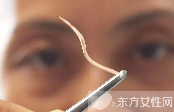 魚(yú)刺卡住了怎么辦 9種小妙招讓你很快消除魚(yú)刺