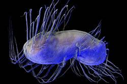 幽門螺旋桿菌感染 4大預(yù)防方法需做好