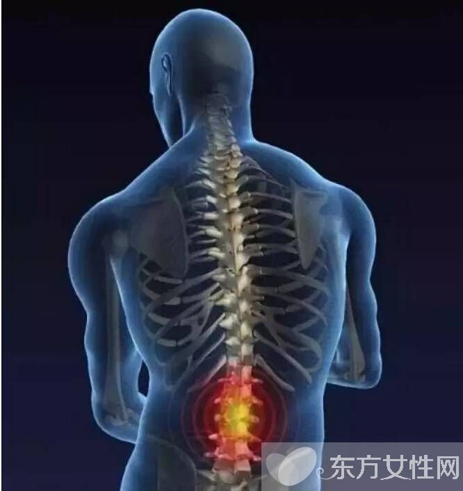 腰椎盤突出怎么鍛煉 腰椎盤突出的4大病因