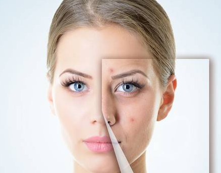 點(diǎn)痣后注意事項(xiàng)有哪些 點(diǎn)痣后不留疤痕要點(diǎn)