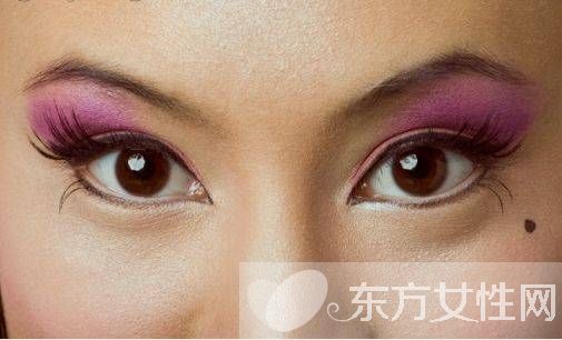 痣是怎么形成的 激光去痣后的6大護(hù)理方法