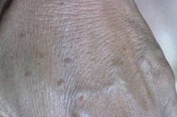 年輕人手上老年斑的原因