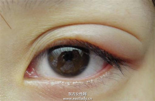 偷看別人洗澡會(huì)長(zhǎng)針眼 科學(xué)讓你知道為什么會(huì)長(zhǎng)針眼