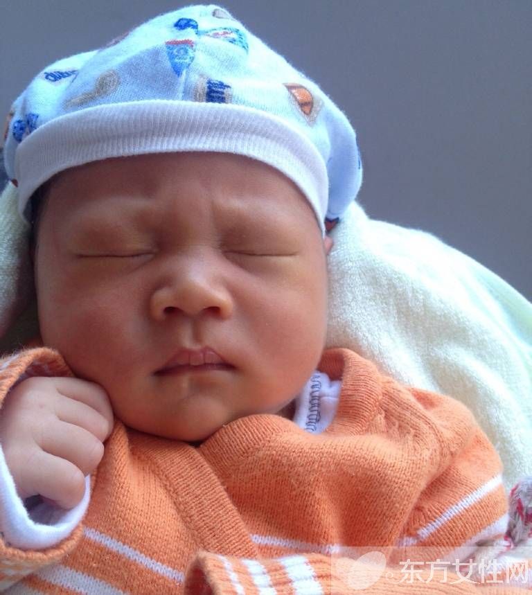 母乳性黃疸怎么治療 如何預(yù)防嬰兒母乳性黃疸