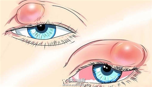 偷看別人洗澡會(huì)長(zhǎng)針眼 科學(xué)讓你知道為什么會(huì)長(zhǎng)針眼