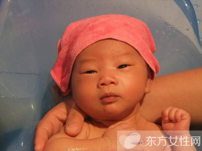 母乳性黃疸怎么治療 如何預(yù)防嬰兒母乳性黃疸