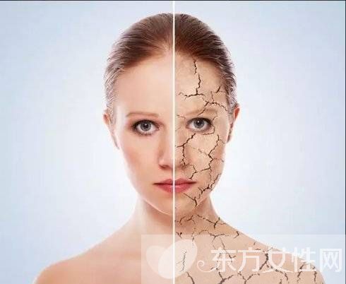 什么方法最快去痘印 溫馨小提示不可忘哦