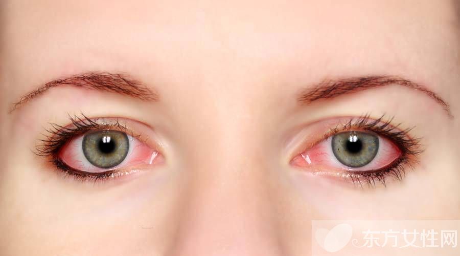 眼底充血是什么原因造成的 怎么快速治療眼底充血