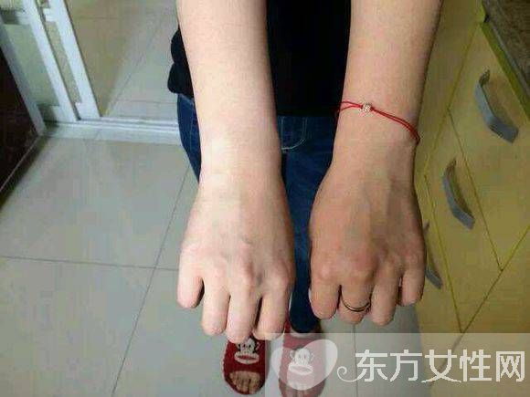 曬黑怎么快速變白 10個美白小偏方告訴你