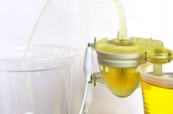 女人小便很黃怎么回事 小便后該用紙擦嗎