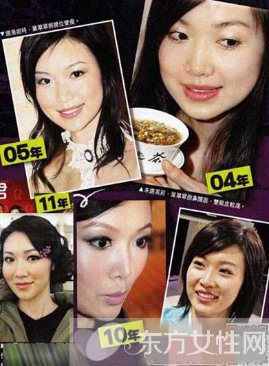 趙薇老公前女友葉翠翠圖片 整容前后照遭吐槽變化驚人