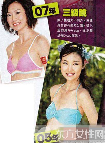 趙薇老公前女友葉翠翠圖片 整容前后照遭吐槽變化驚人