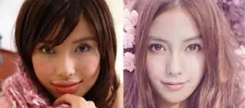 楊穎不雅睡樣照片曝光 楊穎整容前后照流出大方承認(rèn)整容