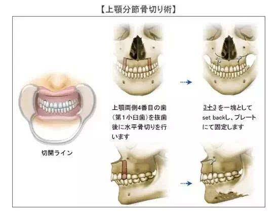 AngelaBaby楊穎父母家庭背景揭秘 整容前后照對比驚人