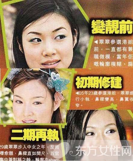 趙薇老公前女友葉翠翠圖片 整容前后照遭吐槽變化驚人