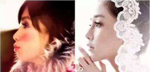 AngelaBaby楊穎父母家庭背景揭秘 整容前后照對比驚人