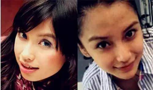 楊穎不雅睡樣照片曝光 楊穎整容前后照流出大方承認(rèn)整容