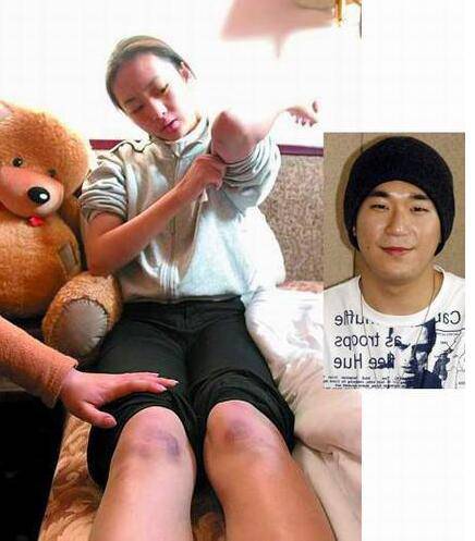 周小北扮演者童瑤個人資料 揭童瑤被打真相