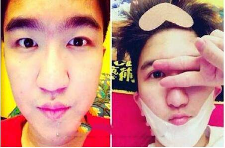 張大大身高是多少 張大大惡心炒作整容照遭扒