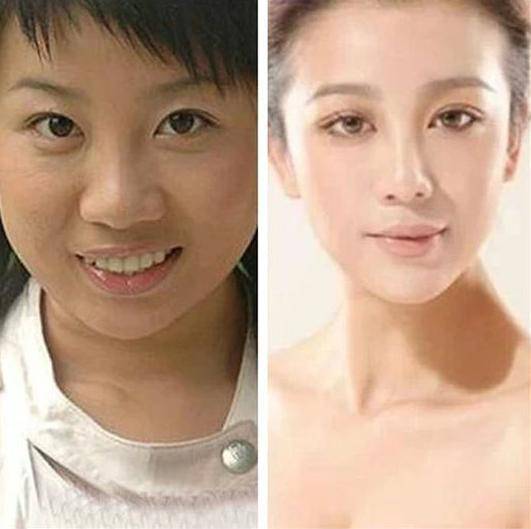 張冬玲和阿寶結(jié)婚照曝光 張冬玲的不良照片遭扒