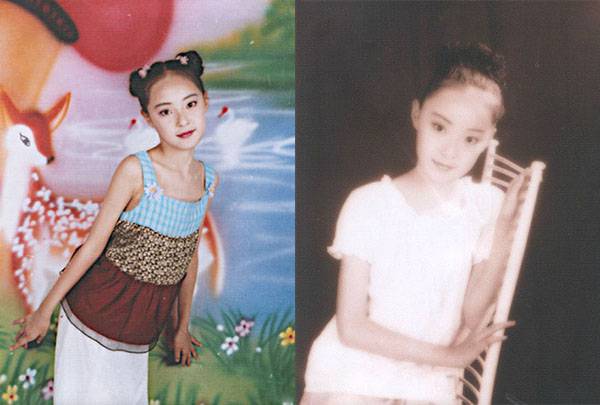 米露個人資料大揭秘 米露臉上有疤是怎么回事